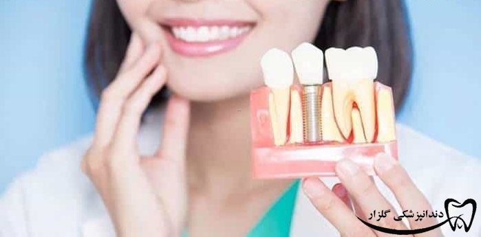 بلیچینگ دندان‌ها در دندانپزشکی زیبایی